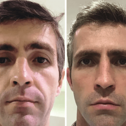 Máscara Coreana de Colágeno Rejuvenescedora Peel Off - Collagen Fit™